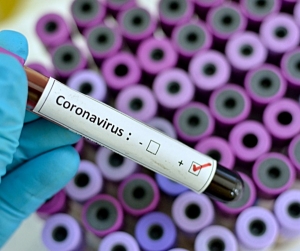 EE.UU: Muertes por coronavirus ascienden a más de 77.000