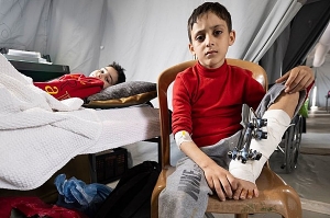 Gaza: 22.000 heridos con secuelas de por vida