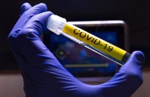 OMS: Improbable que virus del COVID-19 fuera creado